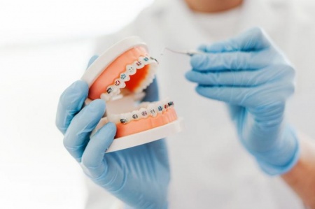 Les tarifs d'orthodontie, comment sont-ils fix&eacute;s par votre sp&eacute;cialiste ?